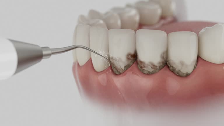 Reliable Dental Implants contractor in Dunlap, TN by Smile Center Dentistry